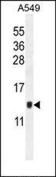 KTAP2 antibody