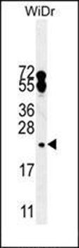 FA96A antibody