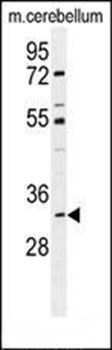 ALKBH6 antibody