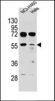TSPYL6 antibody