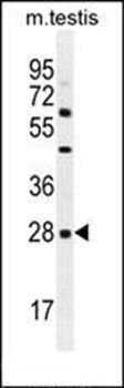CLEC12B antibody