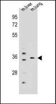 KCNRG antibody