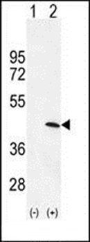 PRKAG1 antibody