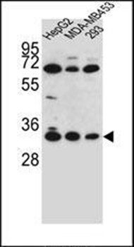 OR2T3 antibody