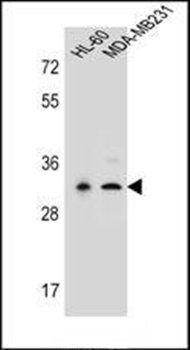 PRSS3 antibody