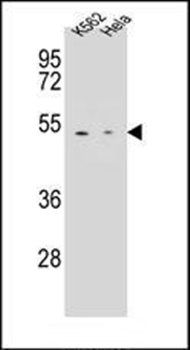 CPB1 antibody