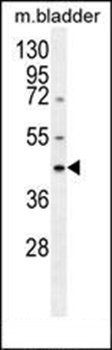Maspin antibody