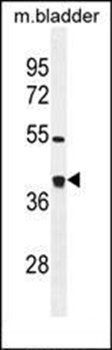 TXNL2 antibody