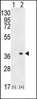 HLA-DQA1 antibody