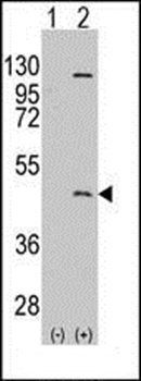 PRMT8 antibody