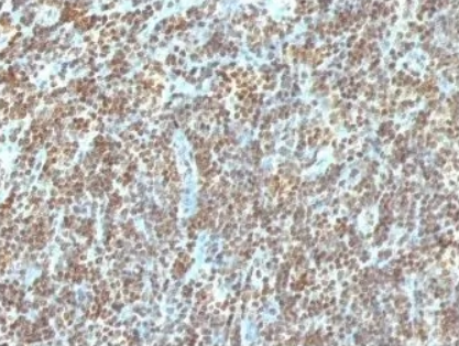 Mouse Double stranded DNA, clone AE-2 (Monoclonal) Antibody