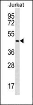 p38 MAPK antibody