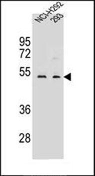 WDR86 antibody