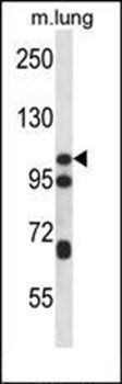 CTNND2 antibody