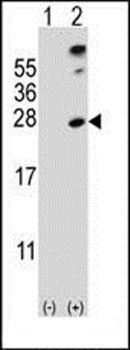 SENP8 antibody