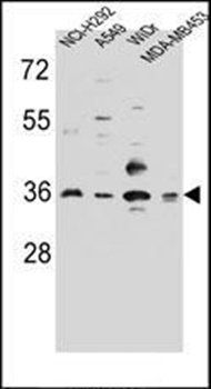 RIC3 antibody