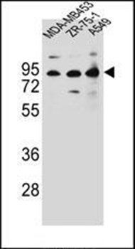 CTTNBP2NL antibody