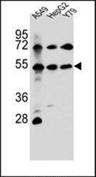 FGFRL1 antibody