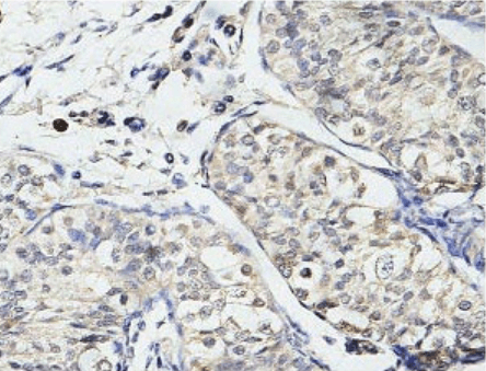 Anti-USP29 Antibody