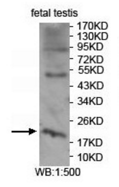 ASRGL1 Rabbit Polyclonal Antibody