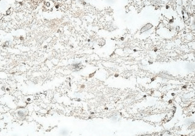 ASRGL1 Rabbit Polyclonal Antibody