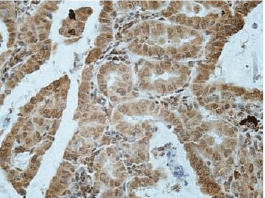 ASGR2 Antibody