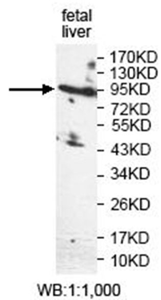 KIAA1161 Rabbit Polyclonal Antibody