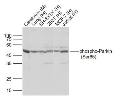 Parkin (phospho-Ser65) antibody