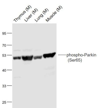 Parkin (phospho-Ser65) antibody