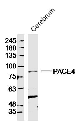 PACE4 antibody