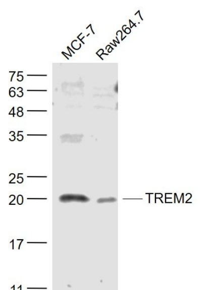 TREM2 antibody
