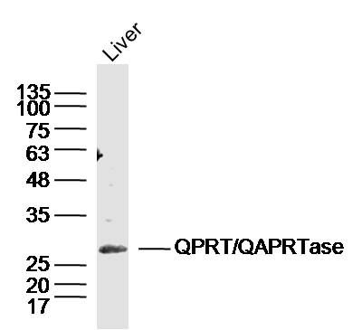QPRT antibody