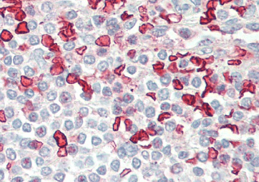 Goat anti-HMBS (aa160-173) Antibody