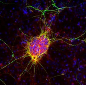Anti-Doublecortin Antibody