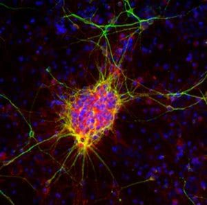 Doublecortin Antibody