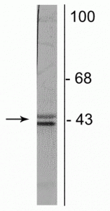 Anti-Doublecortin Antibody