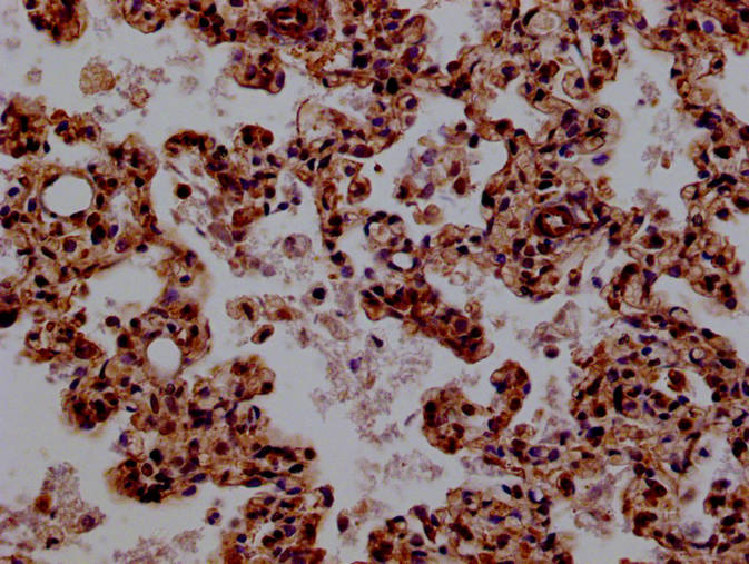 BCL11A antibody