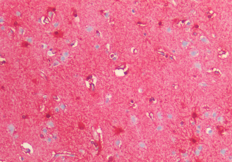 Goat anti-S100B Antibody