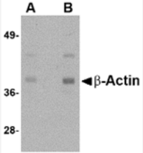Beta-actin Antibody