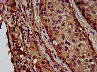 LAPTM4B antibody