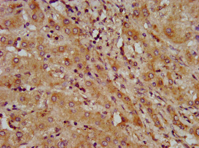 LAPTM4B Antibody