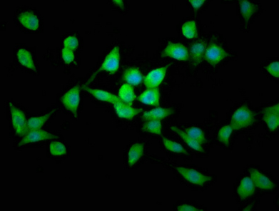 LAPTM4B Antibody