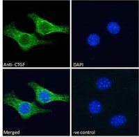 Goat anti-CTGF (aa111-123) Antibody