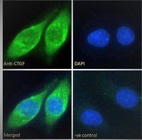 Goat anti-CTGF (aa111-123) Antibody