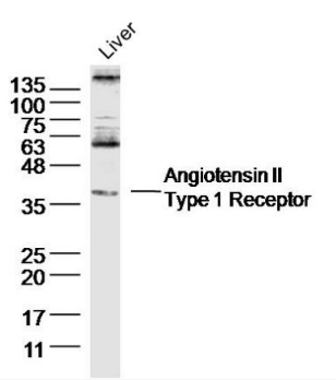 AT1R antibody