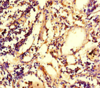 ACOD1 Antibody