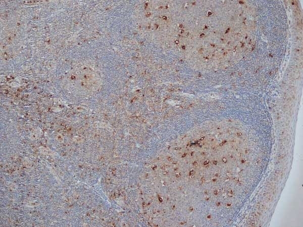 MOUSE ANTI HUMAN CD68:RPE