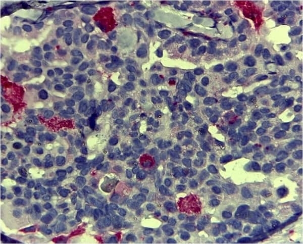 CD68 antibody (RPE)