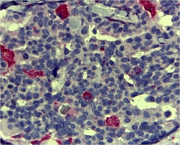 MOUSE ANTI HUMAN CD68:RPE