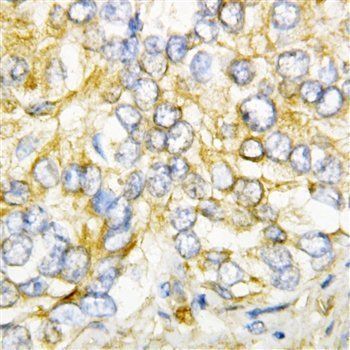 Anti-AIMP2/p38 Antibody